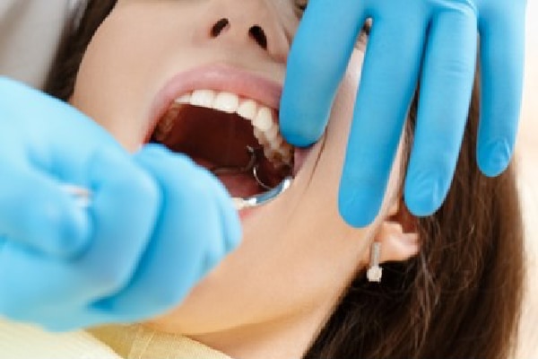 Simple versus complex tooth extraction